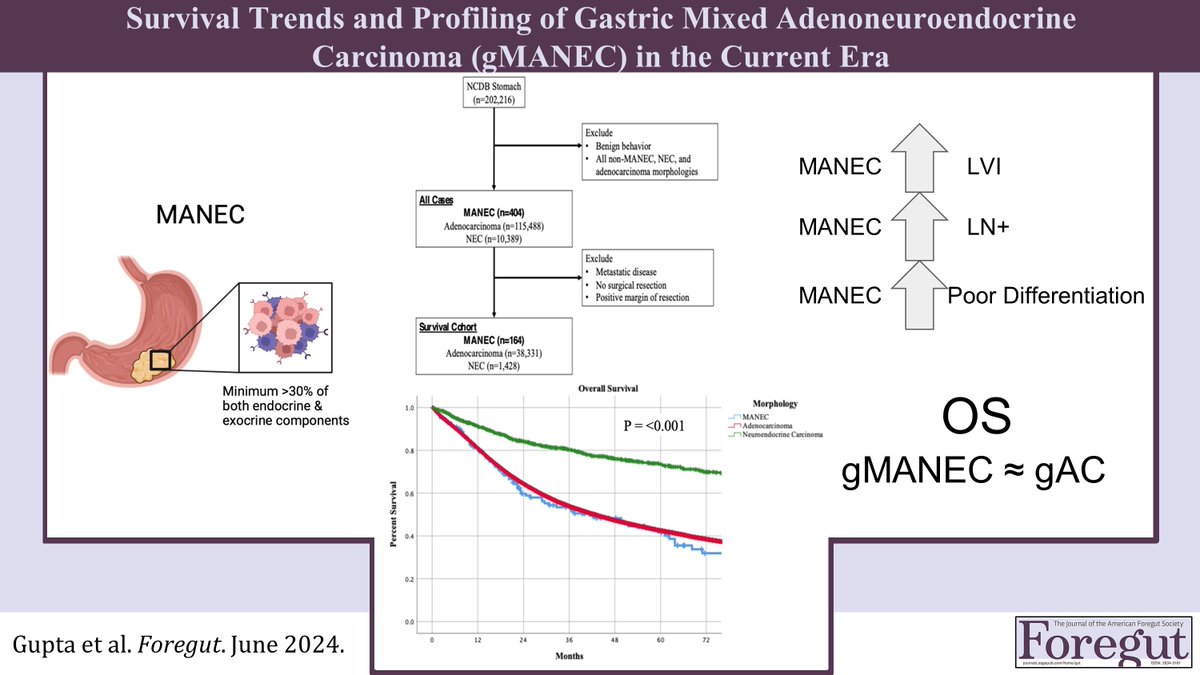 Foregut Journal (@foregut_journal) on Twitter photo Survival Trends and Profiling of Gastric Mixed Adenoneuroendocrine Carcinoma (gMANEC) in the Current Era
πRead Here: journals.sagepub.com/doi/full/10.11β¦
<a href="/shreyaguptaMD/">Shreya Gupta</a> <a href="/UHSurgeryRes/">UH Surgery Residents</a> <a href="/UHhospitals/">University Hospitals</a> <a href="/McDonald_JamesD/">James Mcdonald</a> <a href="/MoffittNews/">Moffitt Cancer Center</a> <a href="/MoffittResearch/">Moffitt Research</a> <a href="/AJRossiMD/">Alexander J. Rossi, M.D.</a> @RWJSurgery <a href="/NCI_SurgOncFel/">NCI Surgical Oncology Research Fellows</a> Survival Trends and Profiling of Gastric Mixed Adenoneuroendocrine Carcinoma (gMANEC) in the Current Era
πRead Here: journals.sagepub.com/doi/full/10.11β¦
<a href="/shreyaguptaMD/">Shreya Gupta</a> <a href="/UHSurgeryRes/">UH Surgery Residents</a> <a href="/UHhospitals/">University Hospitals</a> <a href="/McDonald_JamesD/">James Mcdonald</a> <a href="/MoffittNews/">Moffitt Cancer Center</a> <a href="/MoffittResearch/">Moffitt Research</a> <a href="/AJRossiMD/">Alexander J. Rossi, M.D.</a> @RWJSurgery <a href="/NCI_SurgOncFel/">NCI Surgical Oncology Research Fellows</a>