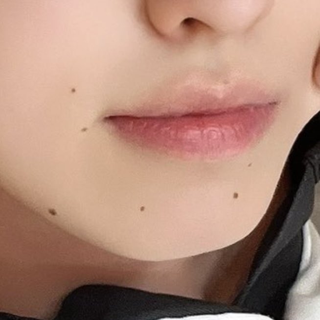 the hedgehog also has 6 moles.. THE DETAILS >>>>>>