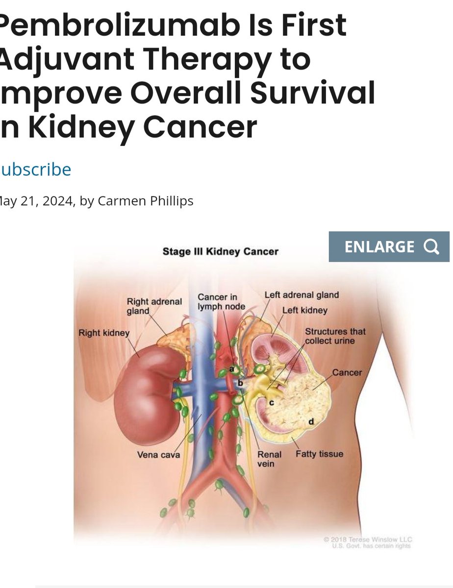 💫🌟📝 Key findings from the pembrolizumab study in kidney cancer:
<a href="/OncoAlert/">OncoAlert</a> <a href="/OncoReporte/">OncoReporte</a>
🔬 First adjuvant therapy to improve overall survival in kidney cancer.

🧑‍🤝‍🧑 91% of patients on pembrolizumab alive at 4 years vs. 86% on placebo.

⏳ 40% reduction in the risk of death with
