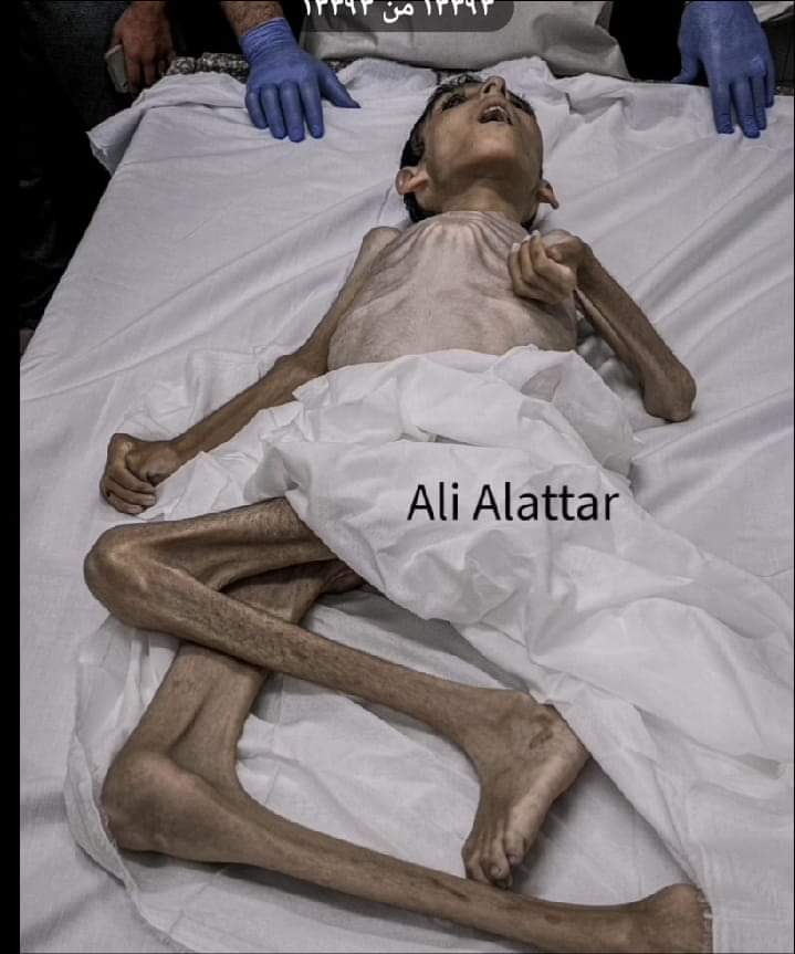 لن اعتذر عن قسوة المشهد
هذه الصورة ملخص لما يحدث

انقذوا المسلمين في قطاع غزة
وكثفوا النشر لانقاذ المسلمين في شمال غزة حيث لا يسمح بوصول اي شيء

#شمال_غزة_يموت_جوعاً