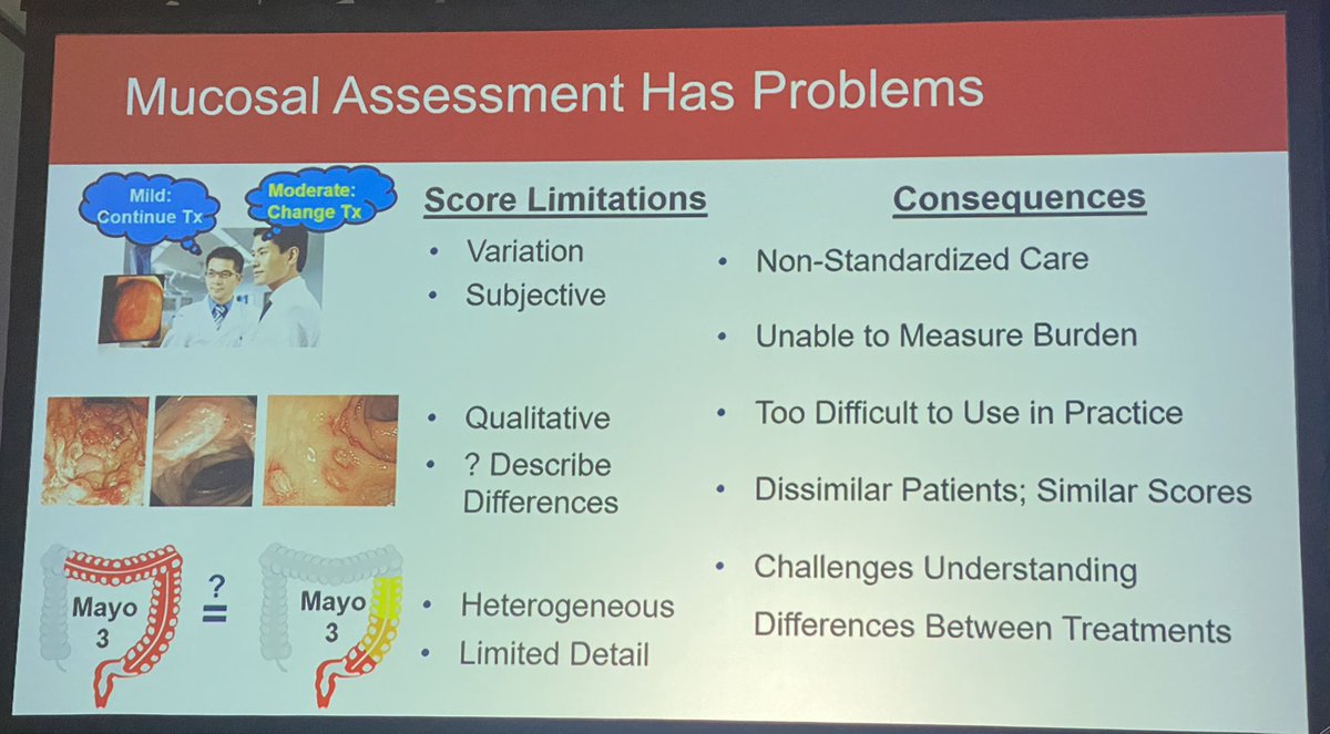 DCharabaty's tweet photo. 🍇#GIReconnect : @CrohnsDoc
🔺Endo Scores are cumbersome, subjective & vary throughout the bowel
🔮Can #AI better assess cumulative disease burden
& give us more insights into mucosal healing in #IBD & Quantify partial response? Provide Histological mapping without biopsies? https://t.co/lDVdavVS5q