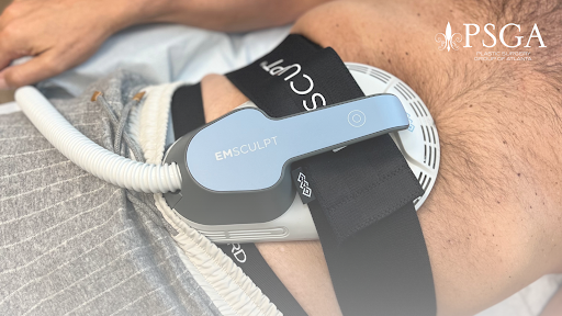 It’s summertime - which means it’s time for EMSCULPT®!

EMSCULPT® is a non-invasive treatment that simultaneously burns fat and builds muscle to sculpt and contour the body.

📞 Call 404-348-4456 to book an appointment

plasticsurgerygroupatl.com/procedures/non…

#Emsculpt #BodyTreatment