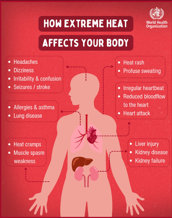 UN's tweet photo. Heat stress is the leading cause of weather-related deaths &amp; can worsen underlying health issues.

As people around the world endure longer, more intense heatwaves due to climate change, @WHO explains how extreme heat impacts human health. https://t.co/5ekhyPX70F https://t.co/ahUnNpLUfM