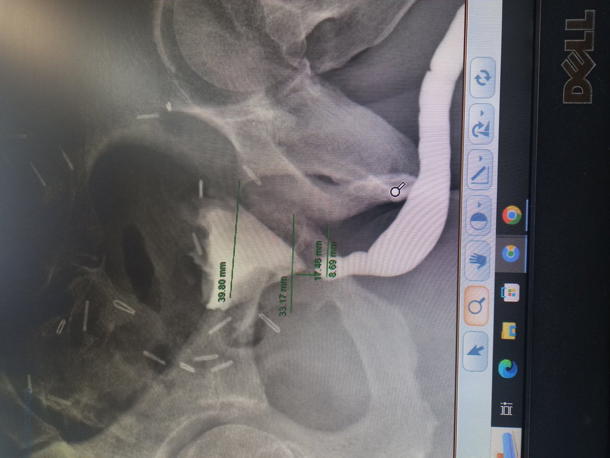 Let's dance!

Post ORP AND DVIU

EPA X BMG?