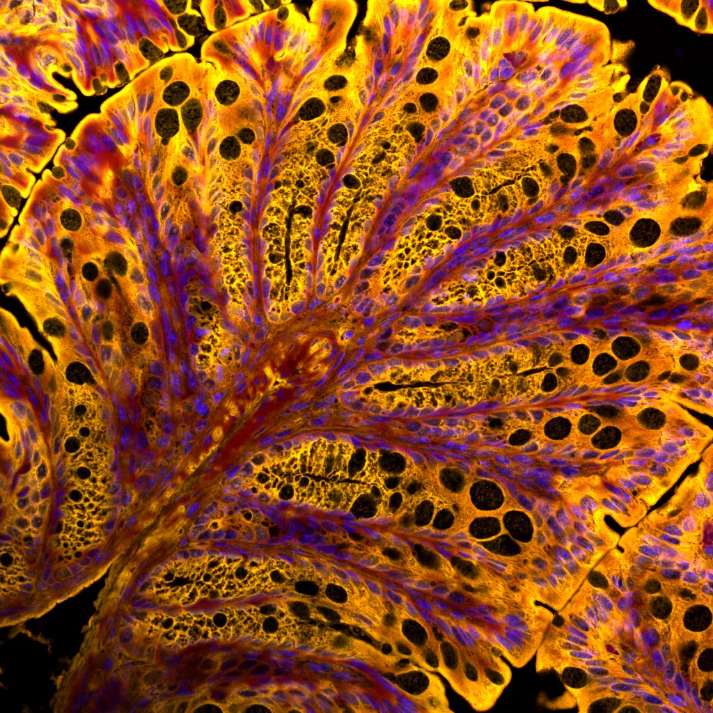 DerekMcKay lab (@lab_derekmckay) on Twitter photo Congratulations to James Sousa whose image (taken as a MSc student in the McKay lab) is currently a finalist in the NSERC Science Exposed
contest.
Vote for him here!
nserc-crsng.gc.ca/ScienceExposed…
#ScienceExposed <a href="/UCalgary/">U Calgary</a> <a href="/UCalgaryMed/">UCalgaryMedicine</a> <a href="/SnyderInstitute/">Snyder Institute for Chronic Diseases</a> <a href="/NSERC_CRSNG/">NSERC / CRSNG</a> <a href="/_Acfas/">Acfas</a> Congratulations to James Sousa whose image (taken as a MSc student in the McKay lab) is currently a finalist in the NSERC Science Exposed
contest.
Vote for him here!
nserc-crsng.gc.ca/ScienceExposed…
#ScienceExposed <a href="/UCalgary/">U Calgary</a> <a href="/UCalgaryMed/">UCalgaryMedicine</a> <a href="/SnyderInstitute/">Snyder Institute for Chronic Diseases</a> <a href="/NSERC_CRSNG/">NSERC / CRSNG</a> <a href="/_Acfas/">Acfas</a>