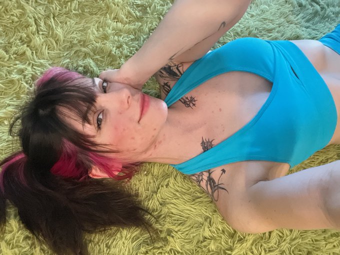 acne scars are doing their thing 😫💔 https://t.co/zYl57SmqWj