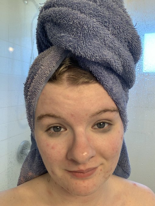 Reminder for the girlies- use makeup remover wipes before you shower. I scrubbed my face so fuckin hard<a href="/tag/mvsales"class="tags"><span>#mvsales</span></a>