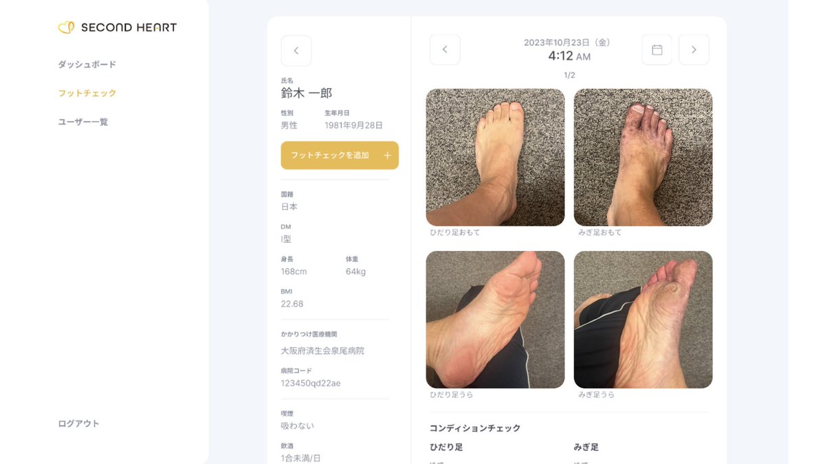 secondheart_jp's tweet image. Steplifeを使うと看護師さんの業務がどのように改善されるかをご紹介：

📈 患者の足の状態をリアルタイムでモニタリング
💬 簡単にフィードバックを提供
📝 電子データで効率的に管理

#セカンドハート #Steplife #看護師 #業務改善 #フットケア