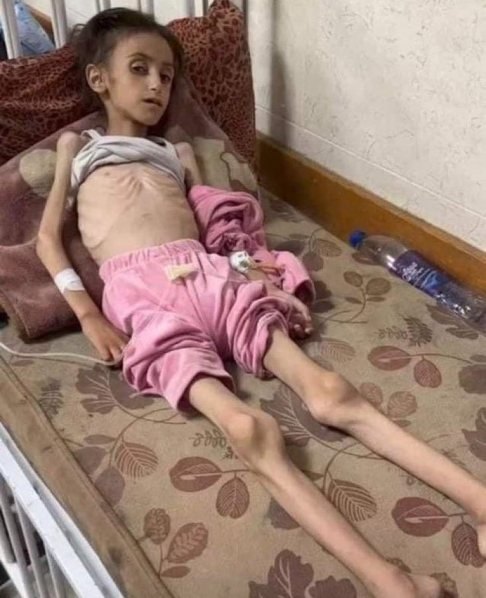 الحرب على أوكرانيا، التي بدأت في فبراير 2022، لم تسبب مجاعة شاملة بفضل الدعم الدولي السريع والمستمر. 

في المقابل، تعاني #غزة من حصار ونقص حاد في الغذاء منذ سنوات، واليوم هي في مجاعة وحرب مدمرة، كما تعاني من انعدام الدعم من دول الجوار، مما يفاقم الأزمة الإنسانية.

اللهم اطعمهم من