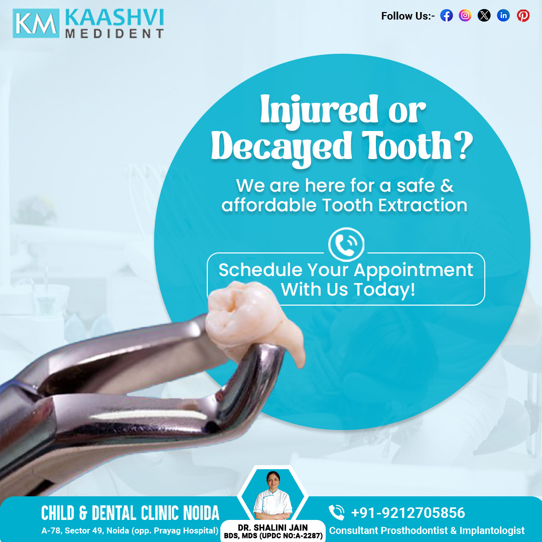 Kaashvi MediDent - Child and Dental Clinic Noida (@kaashvimedident) on Twitter photo ๐๐จ๐ญ ๐๐ง ๐๐ง๐ฃ๐ฎ๐ซ๐๐ ๐จ๐ซ ๐๐๐๐๐ฒ๐๐ ๐๐จ๐จ๐ญ๐ก? ๐๐๐ญ ๐๐ฌ ๐๐๐ฅ๐ฉ!
Experience safe, affordable, and pain-free tooth extractions with our expert dental team. Don't waitโschedule your appointment with us today & take the first step towards a healthier, happier smile! ๐๐จ๐ญ ๐๐ง ๐๐ง๐ฃ๐ฎ๐ซ๐๐ ๐จ๐ซ ๐๐๐๐๐ฒ๐๐ ๐๐จ๐จ๐ญ๐ก? ๐๐๐ญ ๐๐ฌ ๐๐๐ฅ๐ฉ!
Experience safe, affordable, and pain-free tooth extractions with our expert dental team. Don't waitโschedule your appointment with us today & take the first step towards a healthier, happier smile!