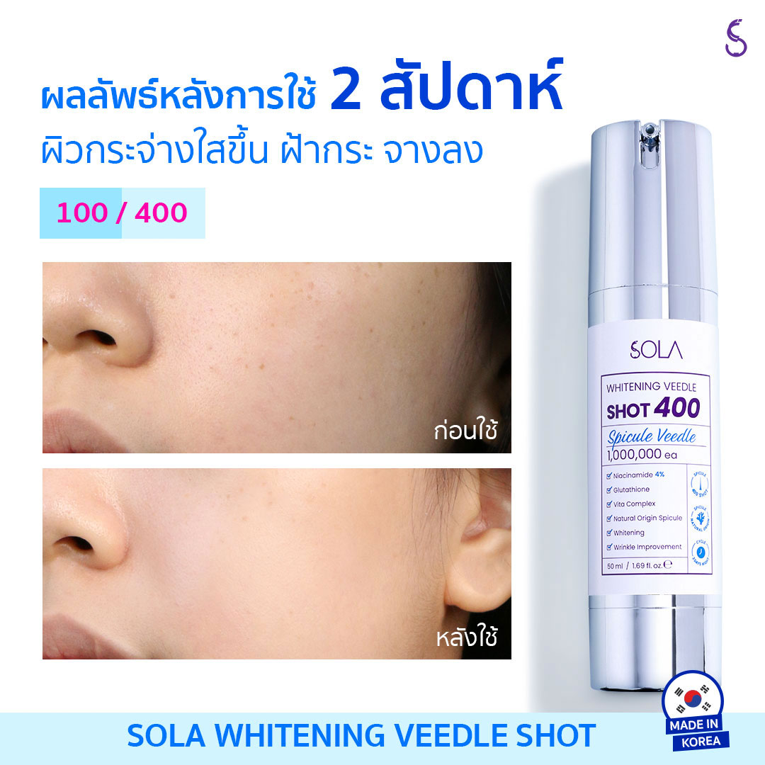 ไอเทมหน้าเด็กแห่งพ.ศ.นี้ที่สาวๆไม่ควรพลาด #โซลาคอลลาเจนวีเดิลช็อต เซรั่มเข็มเปิดผิวนวัตกรรมเกาหลี  ช่วยเปิดผิวสู่การบำรุงที่ล้ำลึกถึงใต้ชั้นผิวหนัง ผิวกระชับ ลดเลือนริ้วรอย ย้อนวัยผิวให้ดูเด็กลงได้ เห็นผลลัพธ์ไวใน 2 สัปดาห์  มีจำหน่ายแล้วที่ #อีฟแอนด์บอย