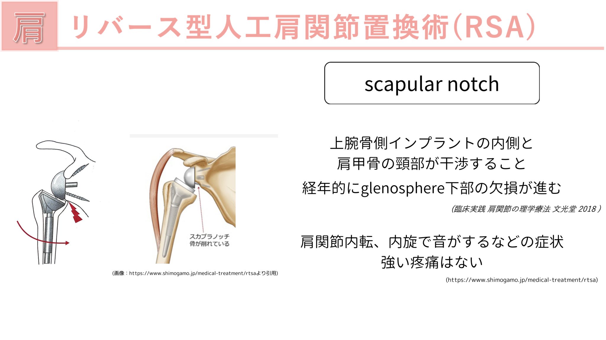 じんた｜運動器疾患に特化した理学療法士 على X: 