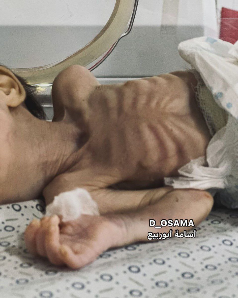 MuhammadSmiry's tweet image. THE NORTH OF GAZA IS STARVING!