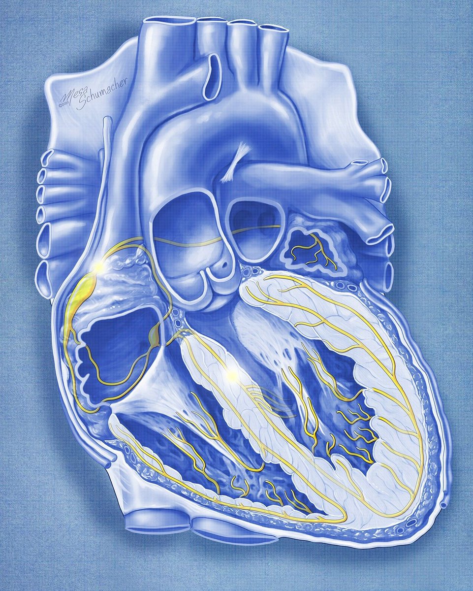 Medical Illustration & Animation (@medillustrates) on Twitter photo Illustration by <a href="/mesabree/">Mesa Schumacher</a> of the electrical pathways of conduction through the heart for stimulating beating.
Explore more work by Mesa Studios: buff.ly/31R7BrI
#heart #cardiac #cardiology #ventricle #vascularsurgery #anatomy #patienteducation #medical #illustration Illustration by <a href="/mesabree/">Mesa Schumacher</a> of the electrical pathways of conduction through the heart for stimulating beating.
Explore more work by Mesa Studios: buff.ly/31R7BrI
#heart #cardiac #cardiology #ventricle #vascularsurgery #anatomy #patienteducation #medical #illustration