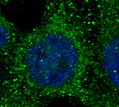 Università di Padova (@unipadova) on Twitter photo 🧬 Scoperto Mytho, il gene che contribuisce ad un invecchiamento sano.
La ricerca, guidata dal prof. Marco Sandri del <a href="/dsb_unipd/">@dsb_unipd</a> in collaborazione dalla prof.ssa Eva Trevisson, è frutto di 9 anni di lavoro.
Scopri di più unipd.link/mytho-scoperta…
<a href="/LabSandri/">Sandri_Lab</a> 🧬 Scoperto Mytho, il gene che contribuisce ad un invecchiamento sano.
La ricerca, guidata dal prof. Marco Sandri del <a href="/dsb_unipd/">@dsb_unipd</a> in collaborazione dalla prof.ssa Eva Trevisson, è frutto di 9 anni di lavoro.
Scopri di più unipd.link/mytho-scoperta…
<a href="/LabSandri/">Sandri_Lab</a>