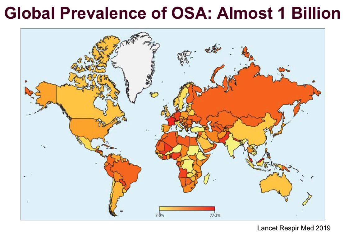 Sleep Apnea #OSA guidelines recommend wt loss/lifestyle changes.
Rather than focusing on lifestyle alone, treating #obesity with more effective/durable methods such as tirzepatide (<a href="/NEJM/">NEJM</a>) or bariatric surgery (<a href="/JACCJournals/">JACC Journals</a>) is required to improve outcomes
bit.ly/3Ro7ZaQ