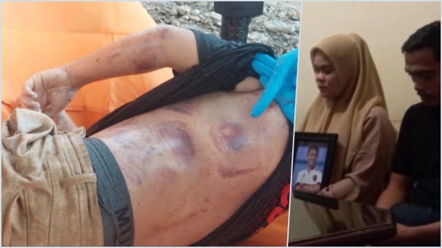 Pengakuan Orangtua Siswa SMP di Padang Tewas Diduga Disiksa Polisi, Sempat Video Call - gelora.co/2024/06/pengak…