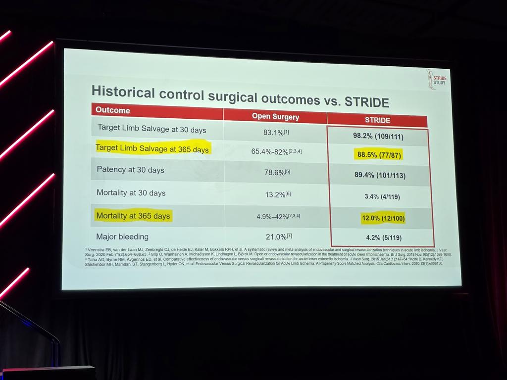 Kenneth Ziegler, MD, FACS, FSVS, RPVI (@ziegler_md) on Twitter photo Suction thrombectomy with Indigo aspiration system is a justified in infrainguinal acute Limb ischemia for vessels >2mm in the STRIDE trial, as presented by <a href="/TomMaldonadoMD/">Thomas Maldonado</a>, coauthor <a href="/Jayer_Chung/">Jayer Chung</a>.
#VAM24 #ALI Suction thrombectomy with Indigo aspiration system is a justified in infrainguinal acute Limb ischemia for vessels >2mm in the STRIDE trial, as presented by <a href="/TomMaldonadoMD/">Thomas Maldonado</a>, coauthor <a href="/Jayer_Chung/">Jayer Chung</a>.
#VAM24 #ALI