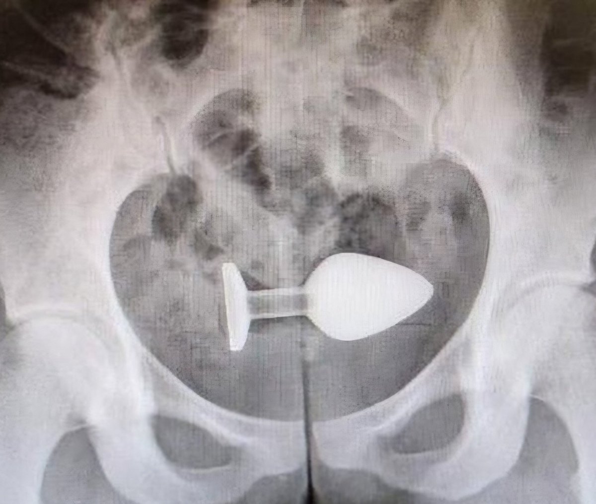 RinaVirtual's tweet photo. Tengan cuidado con lo que comen :( https://t.co/YSF5H5yIOi