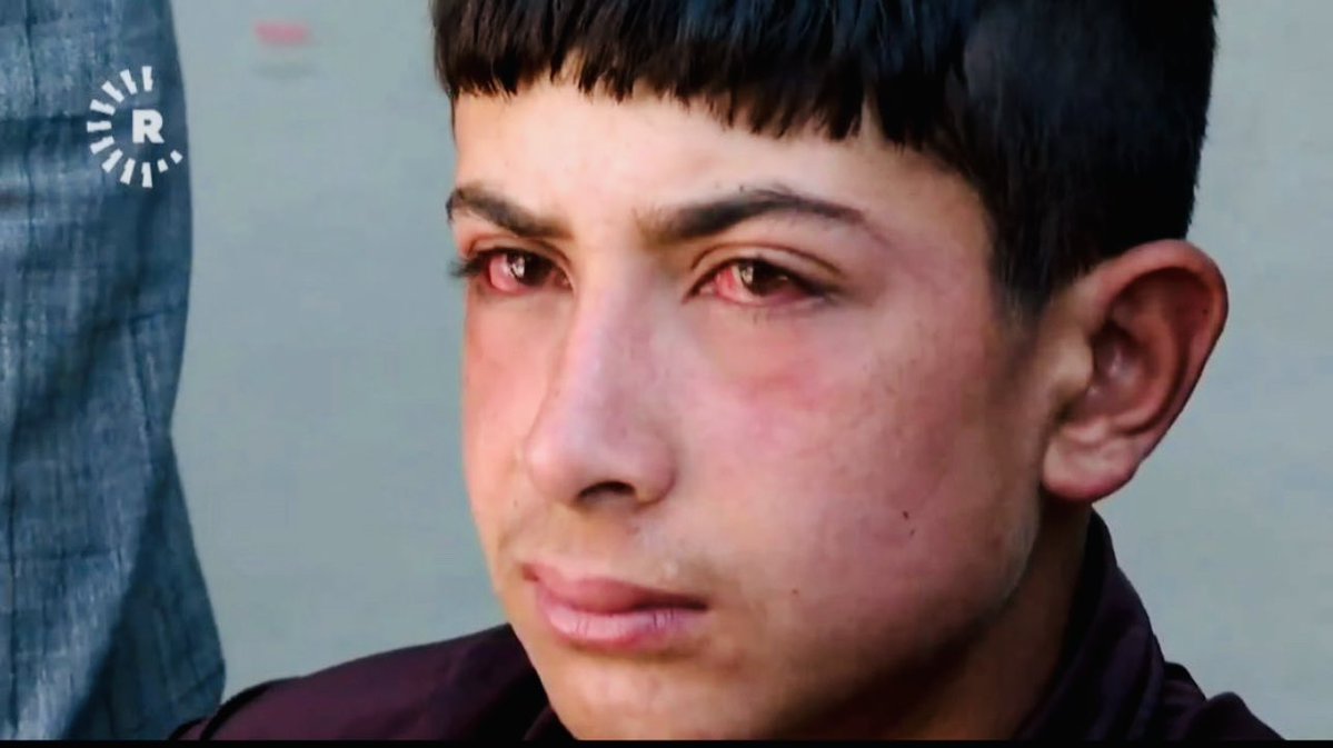 Mardin'de çıkan yangında annesini kaybetti.

📷Rudaw