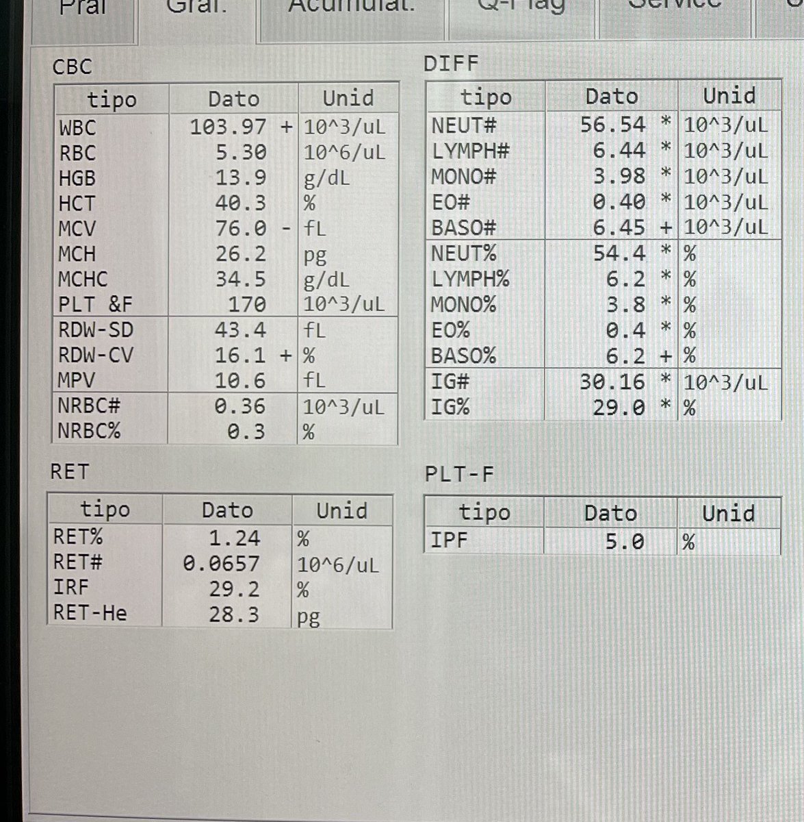 Hoy les comparto desde el laboratorio una imagen de un paciente de 24 años con una leucemia crónica esto es lo que vemos en su hemograma recuento de leucocitos 103.97🚨