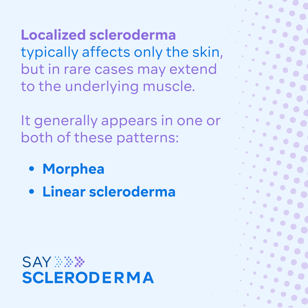 srfcure's tweet image. What exactly is scleroderma, and how does it affect people? Scleroderma is best thought of as a single, yet complex disease that can progress in two main types: Systemic and Localized.
Learn more about scleroderma and how to #SayScleroderma this month: bit.ly/45gjUw4
