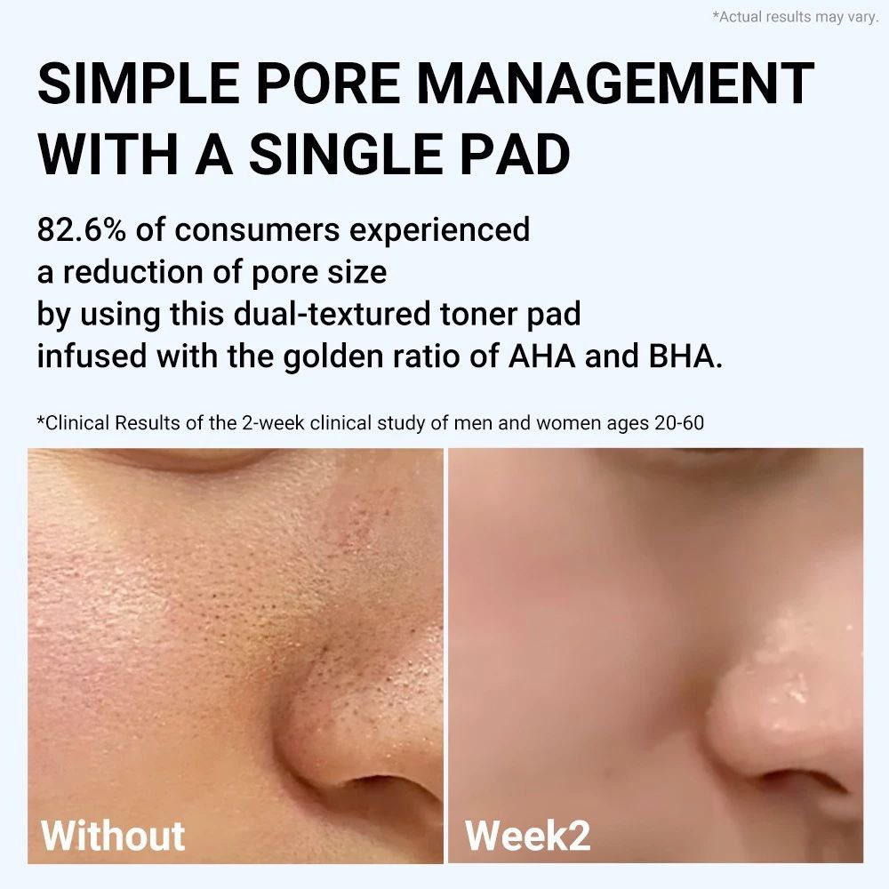 Dalam masa 1 hari 13 jam dari sekarang, 
korang boleh grab medicube toner pad ni pada harga RM25 sahaja 🔥

Memang berbaloii untuk siapa yang nak repeat atau baru nak cuba