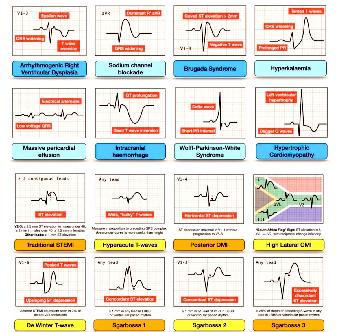 Doctors__squad's tweet photo. ECG Rhythms 📌📌 https://t.co/CY9KyHpM5u