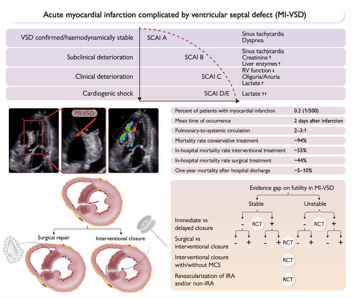 Ventricular septal defect after MI (MI-VSD) has a dismal prognosis close to 100% if left untreated.
Even if treated, mortality is high and RCT evidence is lacking. 

doi.org/10.1093/eurhea…