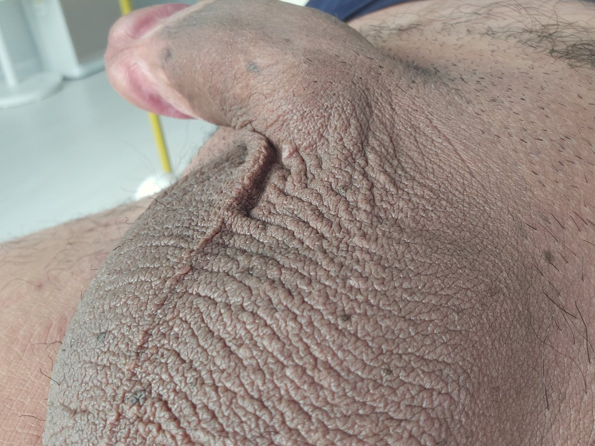 🔞 Hidden 💯 (@shururub0) on Twitter photo 