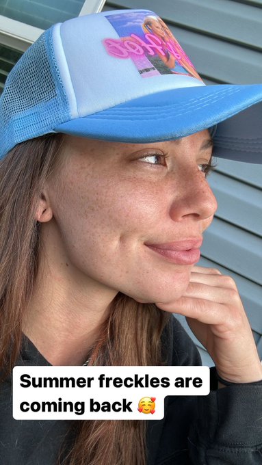 I love summer because my freckles get so much brighter ? https://t.co/mkUwjmqSUL