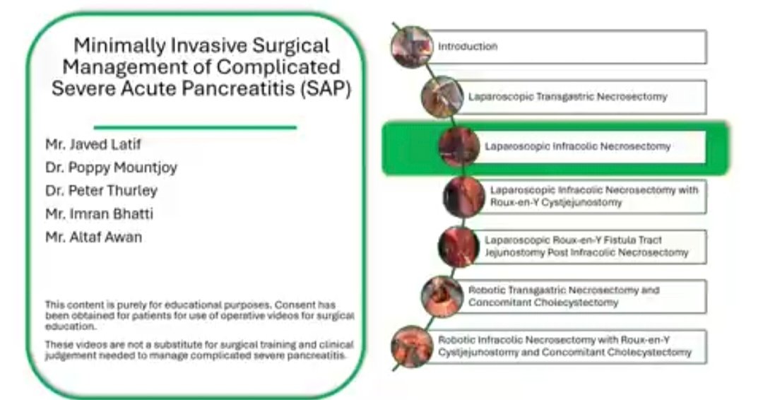 Derby Pancreaticobiliary & Robotic AWR Unit tweet media