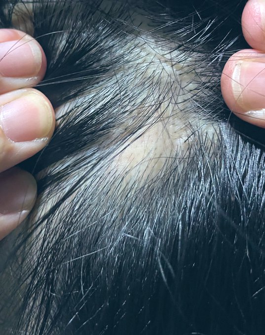 ใๆฒๅ ฑใ10ๅใใฒ?ใใงใใ
ๅๅ ใฏๅฎถใฎไบใชใฎๅใใใใฃใฆใใใฉ้ใใใใชใใใไธๆใไปใๅใฃใฆใใใใใชใใญ๐
ใปใใขใใๅฉใใฆ๐๐๐