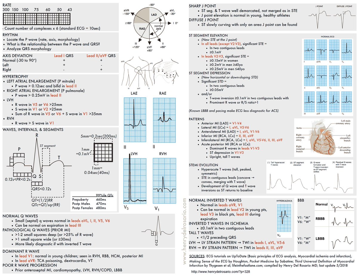 🔴 ECG Cheat Sheet: 

🔹ECG rapid view: It is organized roughly how one would typically read an ECG. 

🔹EKG cheat sheet pdf hits the major points in the order that you might present to another doctor
henrydelrosario.com/?p=328