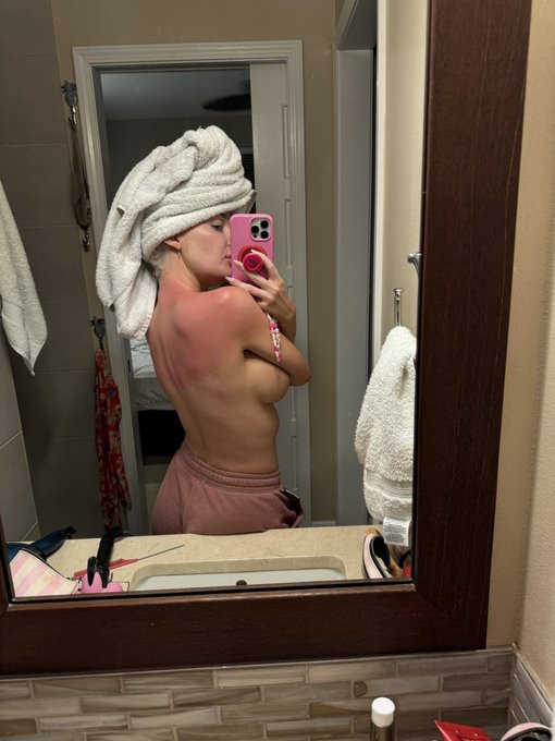 ouchies! home from Hawaii sunburnt and having lazy day in bed. come chat with me it&rsquo;s discounted 💕  https://t