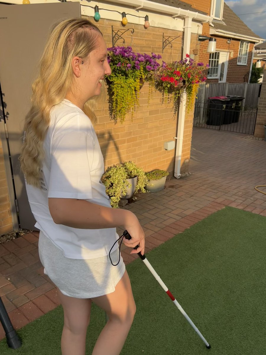 Week one post- brain surgery ✅

Adapting to living with my brain tumour and losing sight continues. 

Back to the Neuroscience department tomorrow 💪