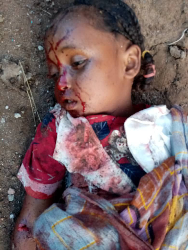 j_hala0000's tweet photo. وفي السّودان أيضًا نَزيفٌ لا يتوقف.!!

اللّهم اكشِف الضُرّ وفرّج الكَرب واحقِن الدّماء https://t.co/2cQqRjiZ4U