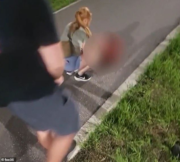 MorbidKnowledge's tweet photo. In June 2024, Ismael Rainey and his girlfriend, Kendall Hardester, were returning home from a date when they stumbled upon a disturbing scene. A man lay motionless by the side of the road, missing his arm, his bone and flesh exposed. 

They quickly rushed to his aid, doing their best to control the bleeding while calling for help.

The man was later identified as Dustin Crousser, a 31-year-old homeless individual who had made a risky decision to swim in alligator-infested waters without any clothes. 

He was taken to the hospital in critical but stable condition. The extent of his injuries led to the amputation of what was left of his arm.