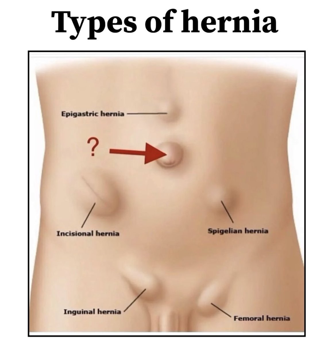 Clinical Case✨
☆☆
#MedEd #Q_Pearls #MedX