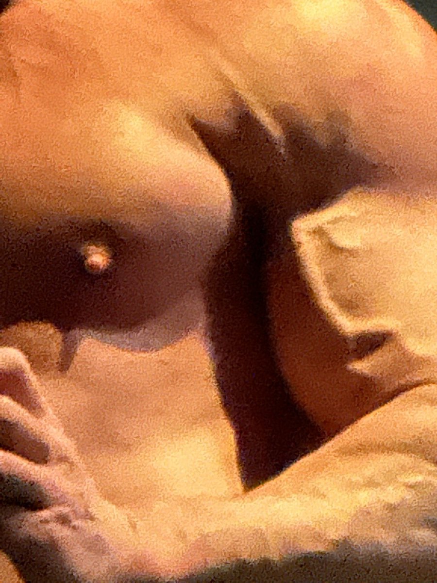 Rick Hammersmith tweet media