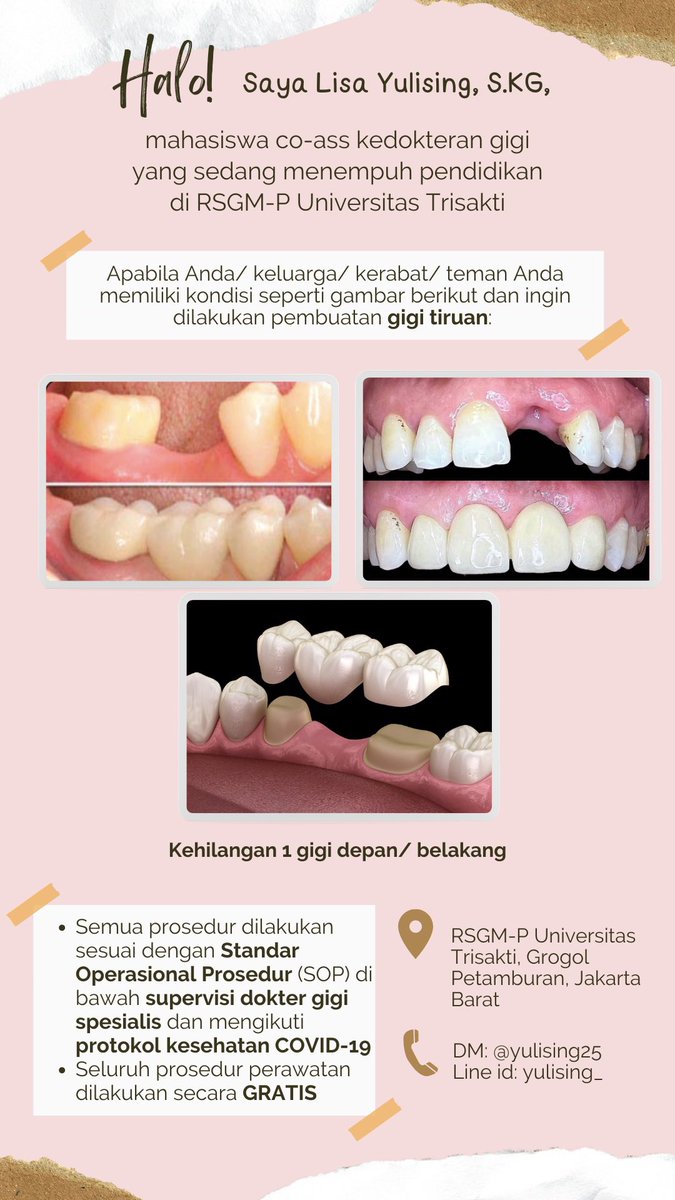 yulising25's tweet photo. Hallo, apabila ada yang kehilangan 1 gigi dan mau dirawat boleh dm aja yaa untuk dibantu perawatannya terima kasih😊#perawatangigi #ompong #sakitgigi #gigi #doktergigi #koasgigi #koas #grogol #jakbar #gigipalsu #gigitiruan #tambal #tambalgigi https://t.co/YcsYxmYU2F