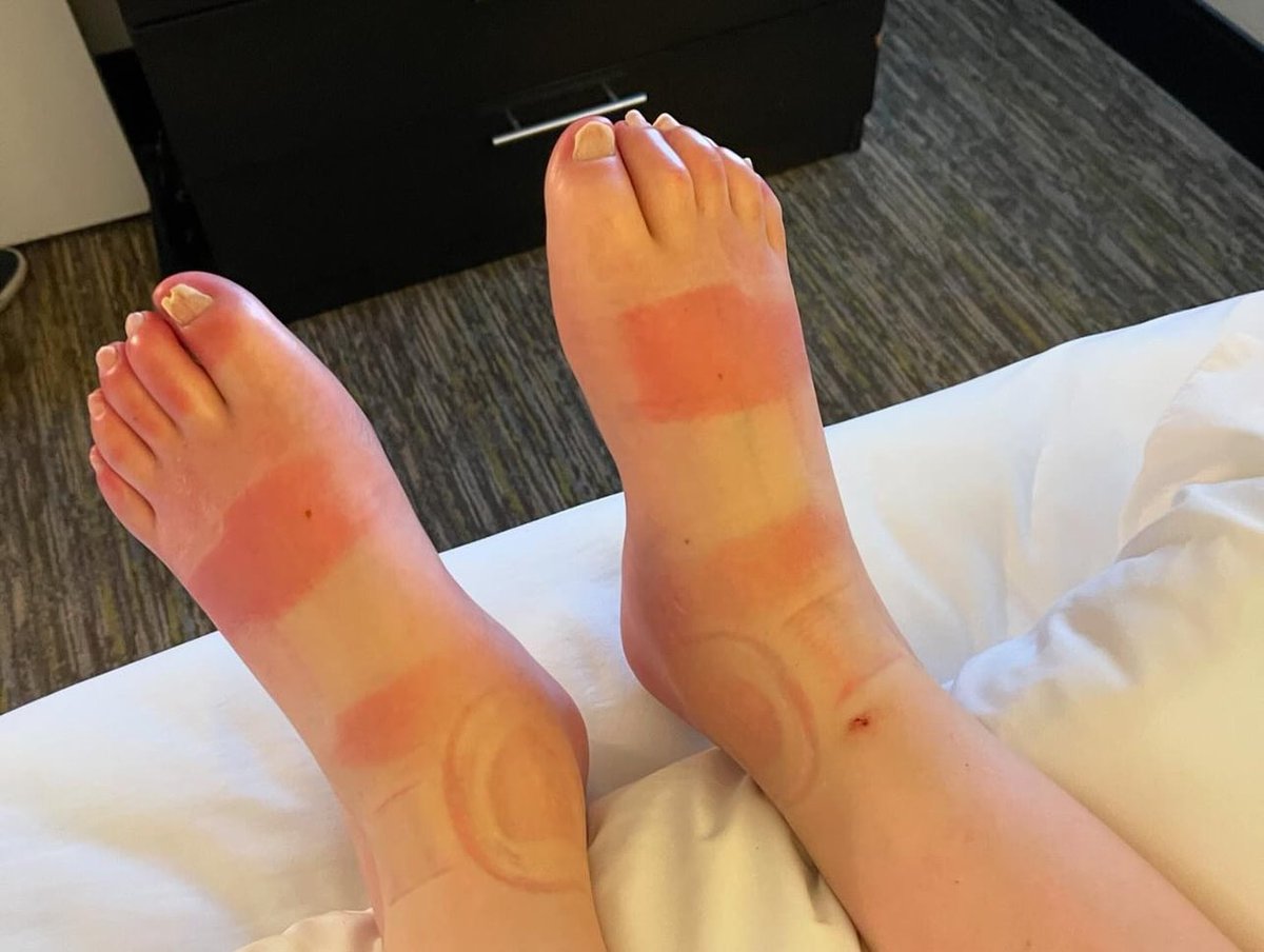 Ian Mackay tweet media