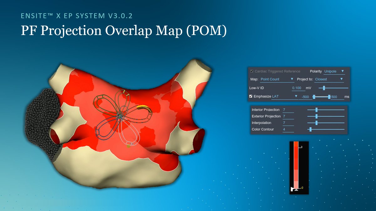 Mike Lean (@mike_lean) on Twitter photo Projection Overlap Map (POM) to show locations with multiple therapy applications in PFA cases.
Here are the map settings we landed on using the “Point Count” map type. Looking forward to seeing what clinical utility this has, and also how the <a href="/AbbottCardio/">Abbott Cardiovascular</a> teams continue to Projection Overlap Map (POM) to show locations with multiple therapy applications in PFA cases.
Here are the map settings we landed on using the “Point Count” map type. Looking forward to seeing what clinical utility this has, and also how the <a href="/AbbottCardio/">Abbott Cardiovascular</a> teams continue to