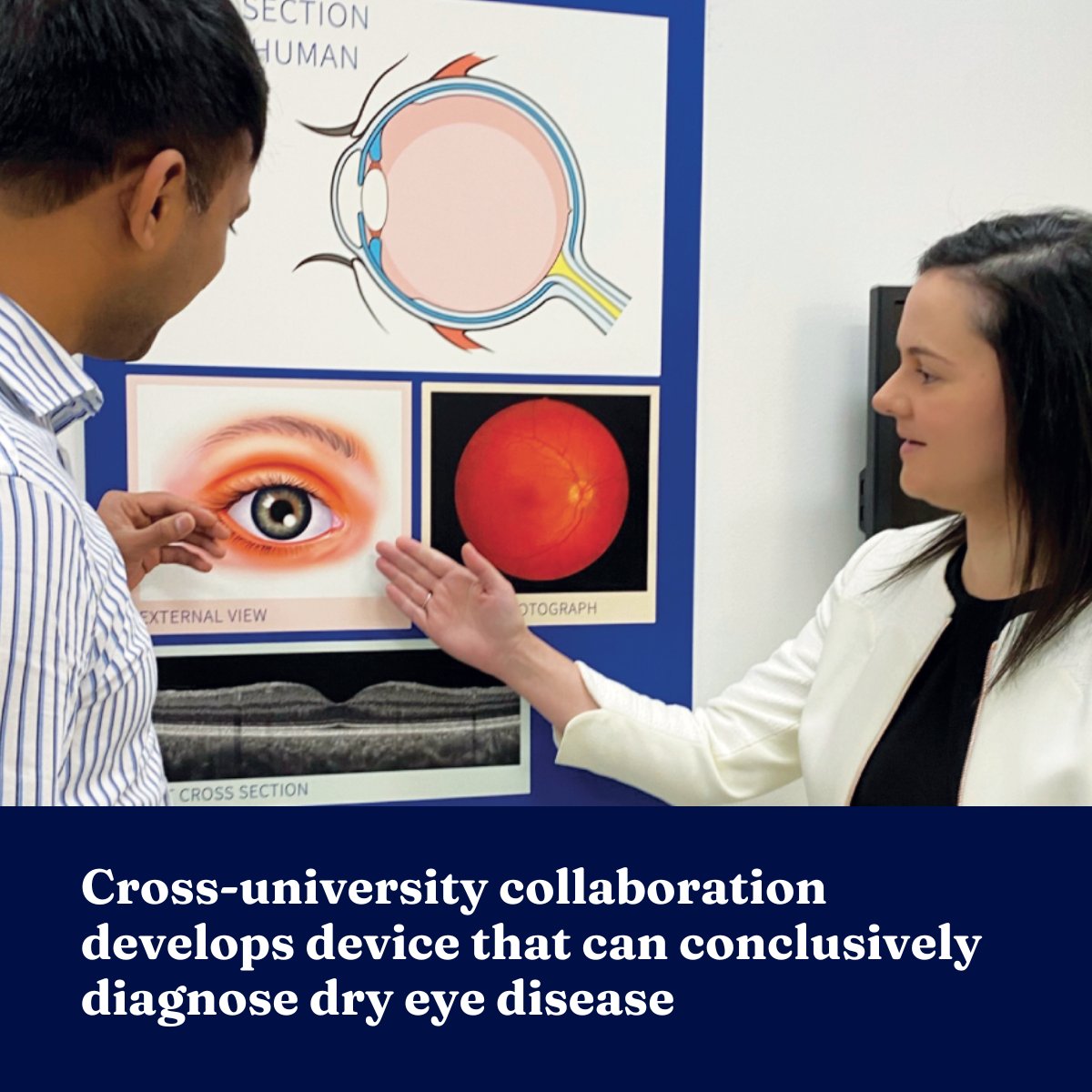 UniMelbDOVS (@unimelbdovs) on Twitter photo Innovative device for dry eye diagnosis on the horizon! Cross-university collaboration led by <a href="/DrLauraDownie/">Prof Laura Downie</a> created ADMiER, which uses a āmini earthquakeā to shake up a droplet of tears and provide a conclusive diagnosis. Read more here: thenewoptometrist.com/features/smallā¦
<a href="/BRT_LungGuy/">Professor Bruce Thompson AM</a> Innovative device for dry eye diagnosis on the horizon! Cross-university collaboration led by <a href="/DrLauraDownie/">Prof Laura Downie</a> created ADMiER, which uses a āmini earthquakeā to shake up a droplet of tears and provide a conclusive diagnosis. Read more here: thenewoptometrist.com/features/smallā¦
<a href="/BRT_LungGuy/">Professor Bruce Thompson AM</a>