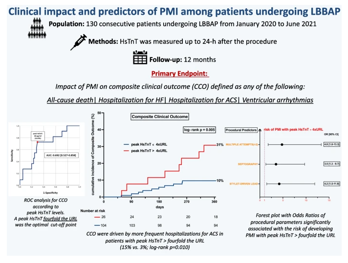 JICE (@jice_ep) on Twitter photo 🚨New #FreeRead Article in
<a href="/JICE_EP/">JICE</a>
Clinical Impact & Predictors of Periprocedural Myocardial Injury Among Patients Undergoing Left Bundle Branch Area Pacing (LBBAP)
🧐📖rdcu.be/dM6FS
by <a href="/edobressi/">Edoardo Bressi</a>, <a href="/KamilSedlacek/">Kamil Sedlacek</a>, <a href="/curilakarol/">curilakarol</a>, <a href="/OCanoPerez/">Óscar Cano</a>, <a href="/JLuermans/">Justin Luermans</a>, Jesse H. J. 🚨New #FreeRead Article in
<a href="/JICE_EP/">JICE</a>
Clinical Impact & Predictors of Periprocedural Myocardial Injury Among Patients Undergoing Left Bundle Branch Area Pacing (LBBAP)
🧐📖rdcu.be/dM6FS
by <a href="/edobressi/">Edoardo Bressi</a>, <a href="/KamilSedlacek/">Kamil Sedlacek</a>, <a href="/curilakarol/">curilakarol</a>, <a href="/OCanoPerez/">Óscar Cano</a>, <a href="/JLuermans/">Justin Luermans</a>, Jesse H. J.