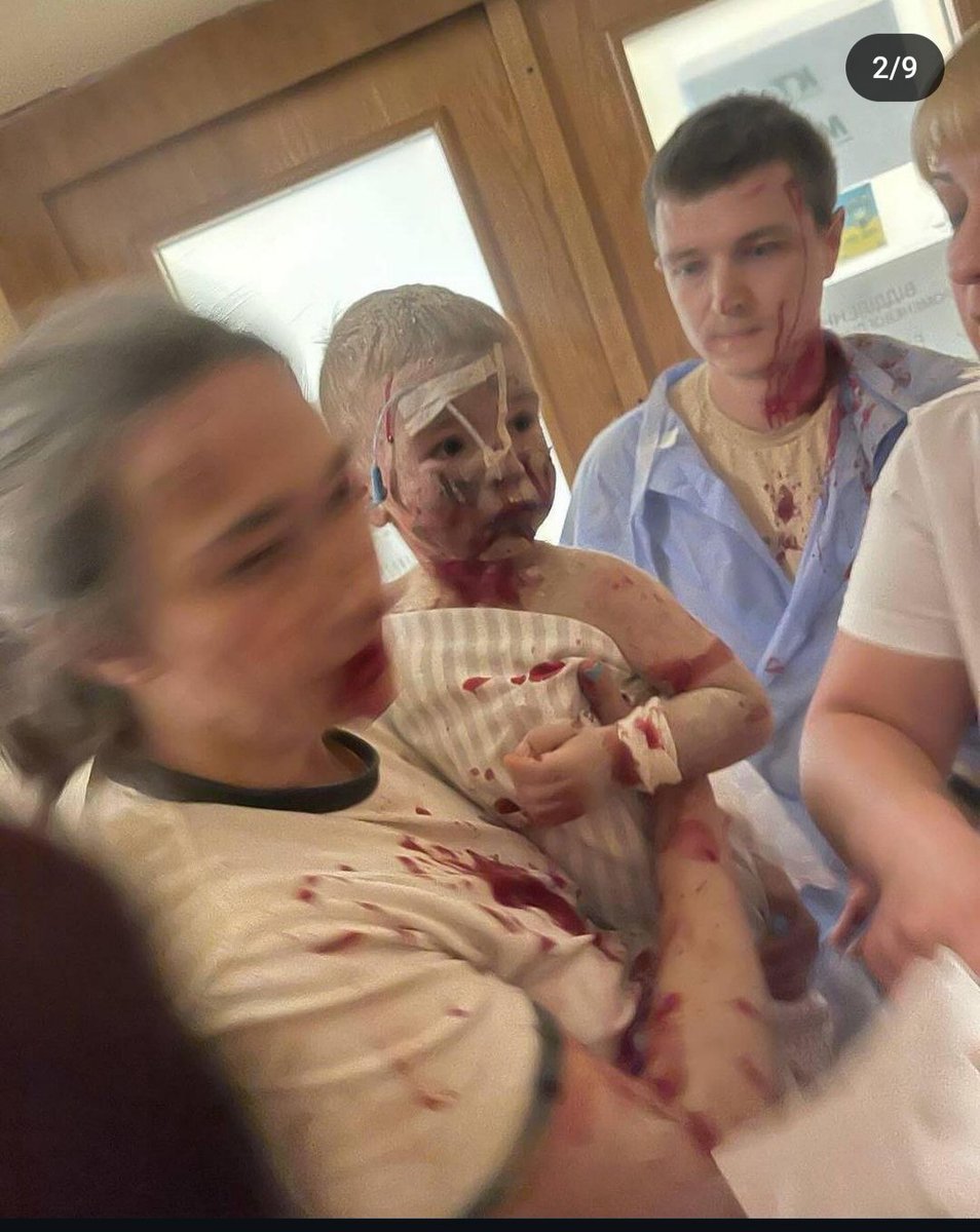 ZLevkovskij's tweet photo. @JoeBiden Russian terrorists hit one of the most famous maternity and hospitals in Kyiv called ,,Ohmatdyt,,Children under the rubble.numbers for help
TRC-20-TKLFnbJxBKmndPNW9jRYtseCMpR4bB2KWp
PayPal-levkovskijzena@gmail.com https://t.co/51bSnx0HBE