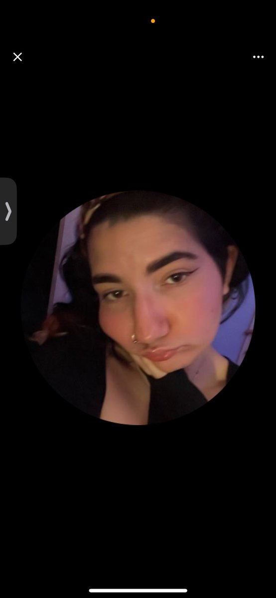 Mei ˙⋆✮ jaeyi’s moles tweet media