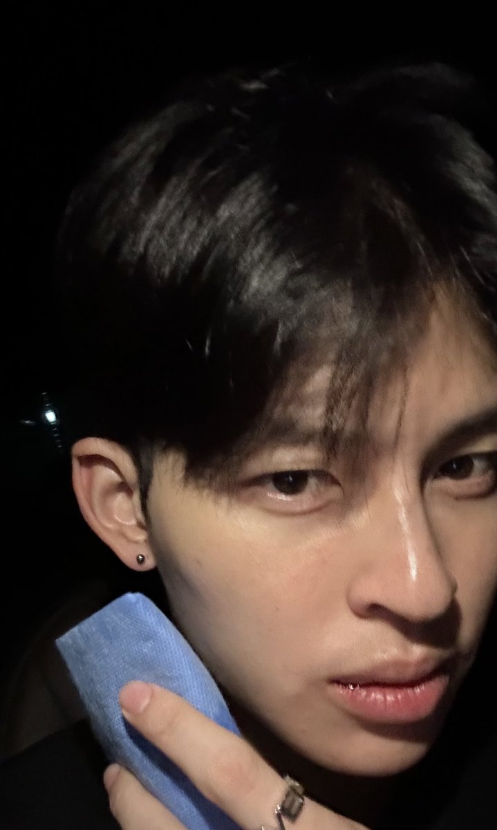 naravlt's tweet image. Oke masih keliatan bengkak ga sih