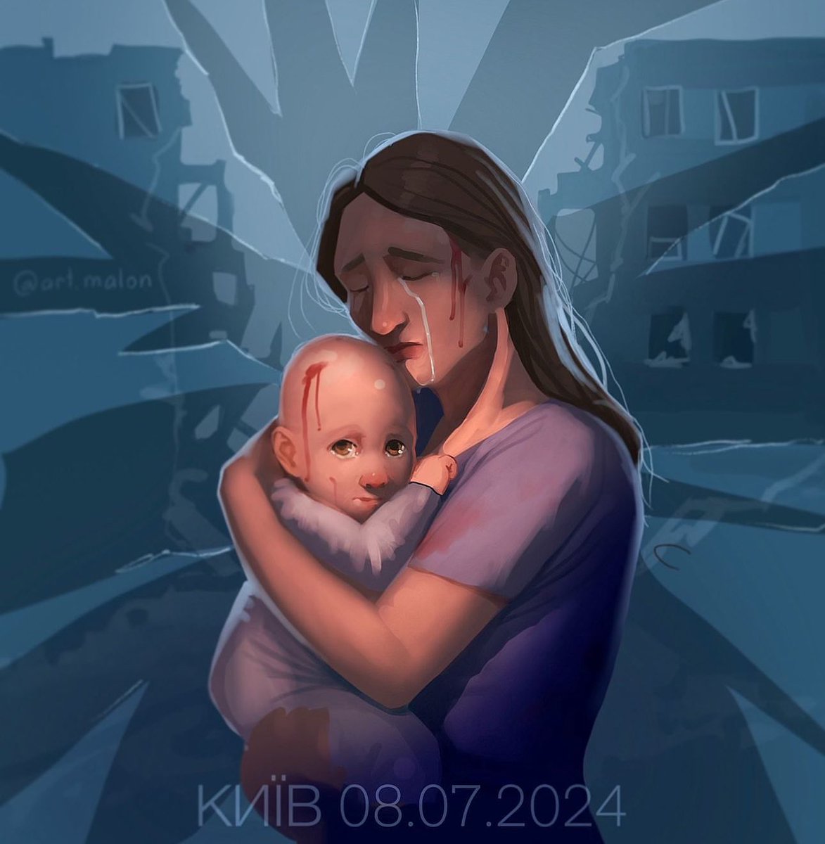 Kiev 💔

17 dead and 41 wounded. 

Radiation on residential buildings, as well as on the building of #Ohmadit
When I saw the photos of injured children in the hospital.
(I felt a very deep sense of fear.)

Children are the future, and Russia continues to destroy them.

#NoWar
