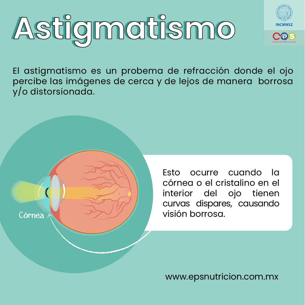 INCMNSZ_EPS's tweet image. #Astigmatismo | Instituto Nacional de Ciencias Médicas y Nutrición Salvador Zubirán

#Oftalmólogo #Visión #Ojos #Vista #VerDeLejos #VerDeCerca #ProblemasOculares #EnfermedadesOculares #Retina #ProblemaDeRefracción #VisiónBorrosa #FatigaOcular #EPS #INCMNSZ
